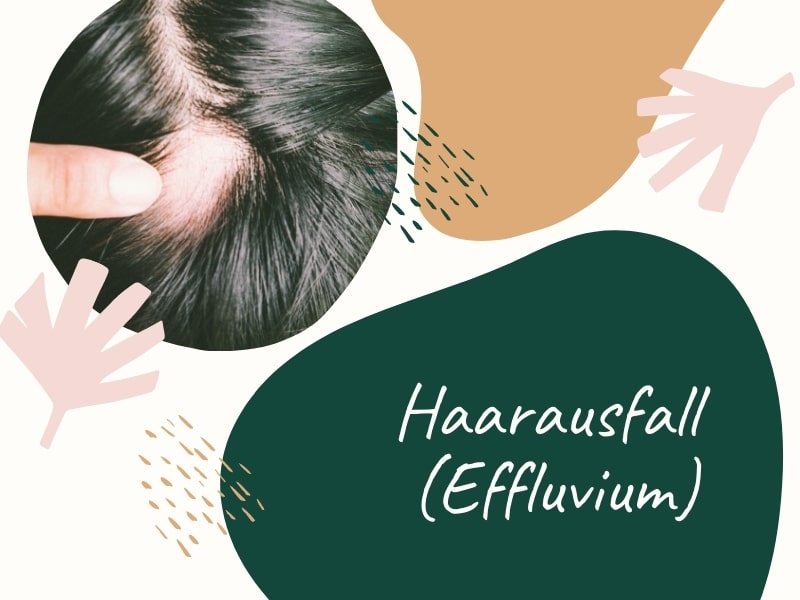 Haarausfall (Effluvium) – Wenn das Haarwachstum gestört ist