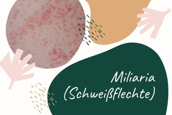 Miliaria: zumeist juckendes Exanthem und dermatologische Hauterkrankung