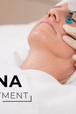 © BEAUTY HILLS SYNA - non-invasive Jetstream-Technologie zur Hautverjüngung