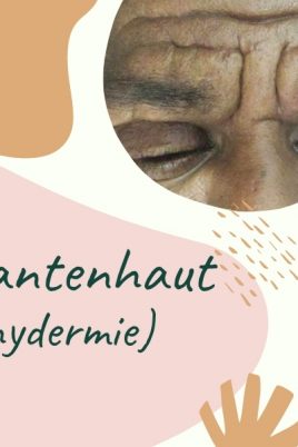 Pachydermie - hypertrophe Hautkrankheit