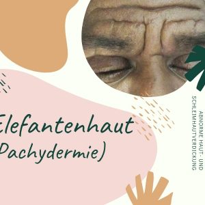 Pachydermie - hypertrophe Hautkrankheit