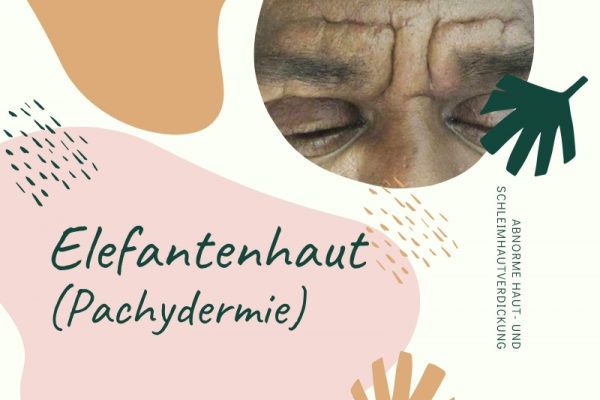 Pachydermie - hypertrophe Hautkrankheit